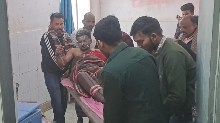 पेट्रोल में आग लगने से दुकानदार झुलसा