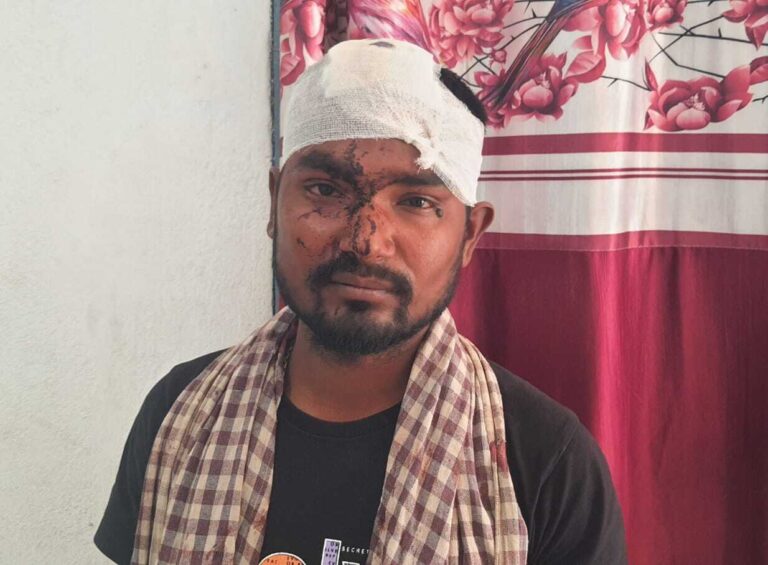 बिजली तार में टोंका लगाकर मछली मारने के विवाद में हुई मारपीट