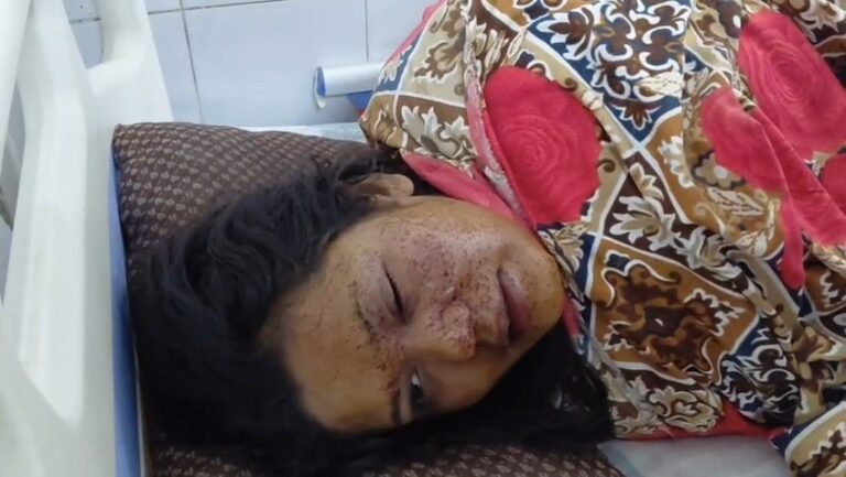रिसेप्शन में गूंजा फायर, आर्केस्ट्रा की महिला कलाकार हुई घायल
