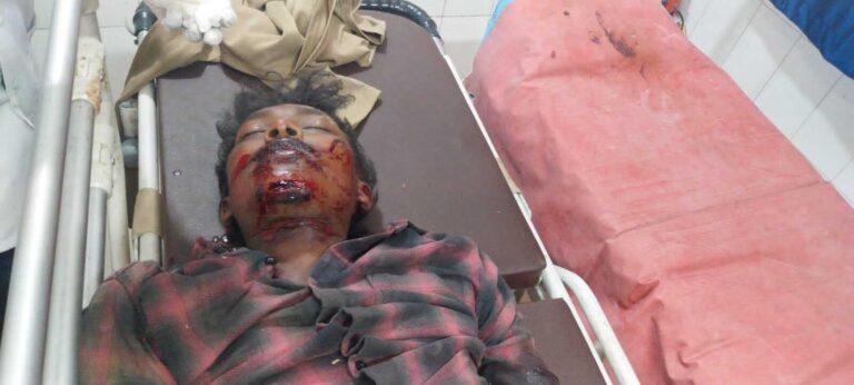 Seraikela Kharsawan News  : एनएच-33 और वन-वे पुल पर हादसों में तीन की मौत