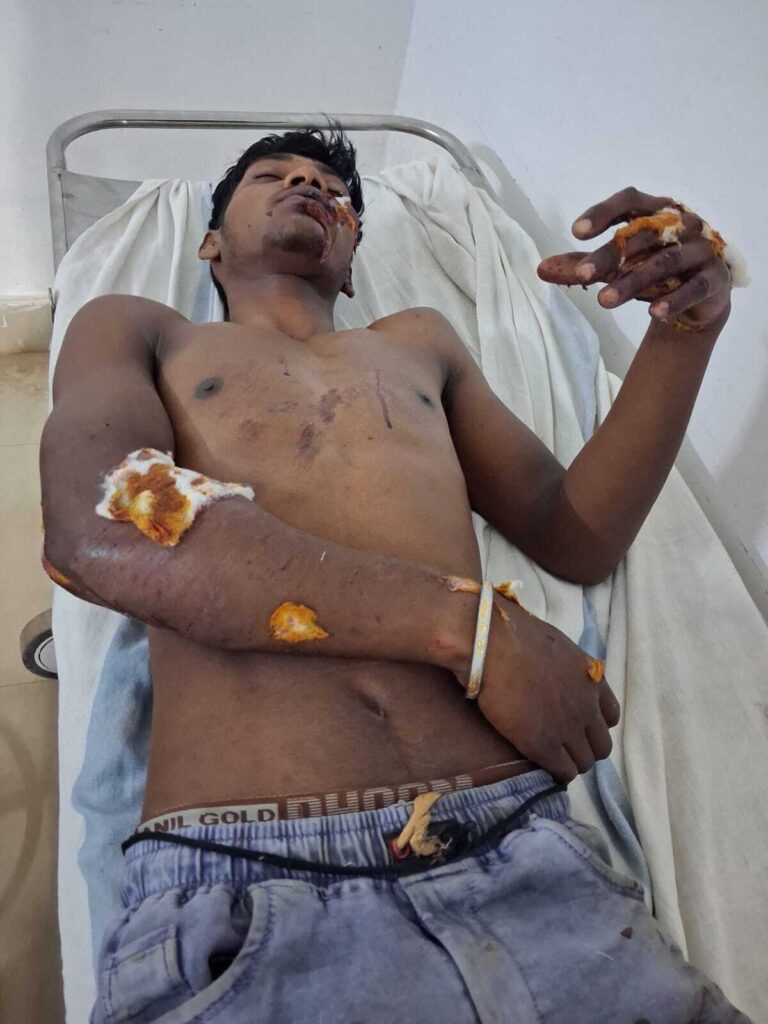 तेज रफ्तार स्कूटी की टक्कर से युवक घायल