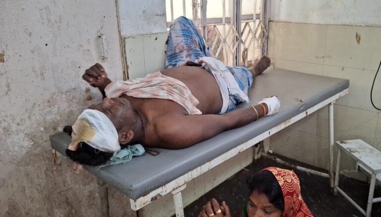 मजदूरी के पैसे मांगने पर मजदूर के सिर पर रॉड से हमला,  हालत नाजुक