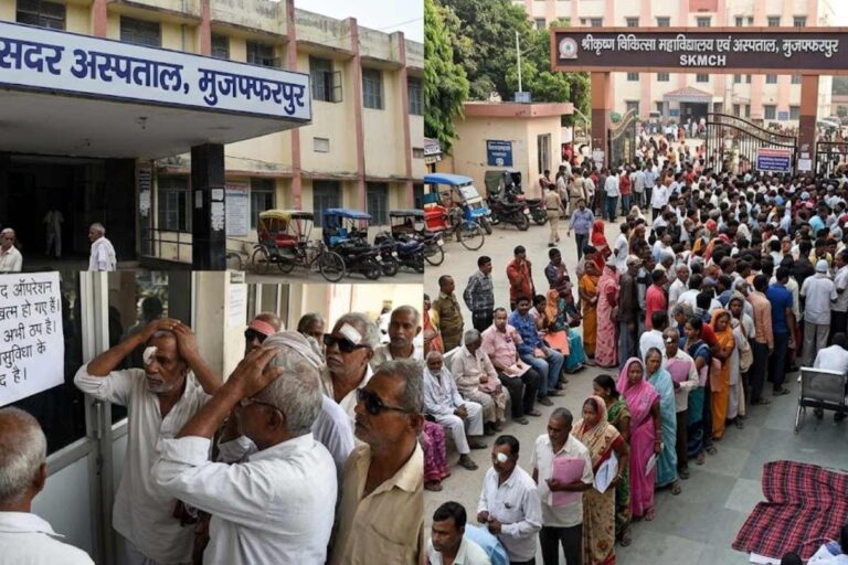 मुजफ्फरपुर: सदर अस्पताल में लेंस खत्म होने से मोतियाबिंद ऑपरेशन ठप, एसकेएमसीएच  में लगी मरीजों की भारी भीड़
