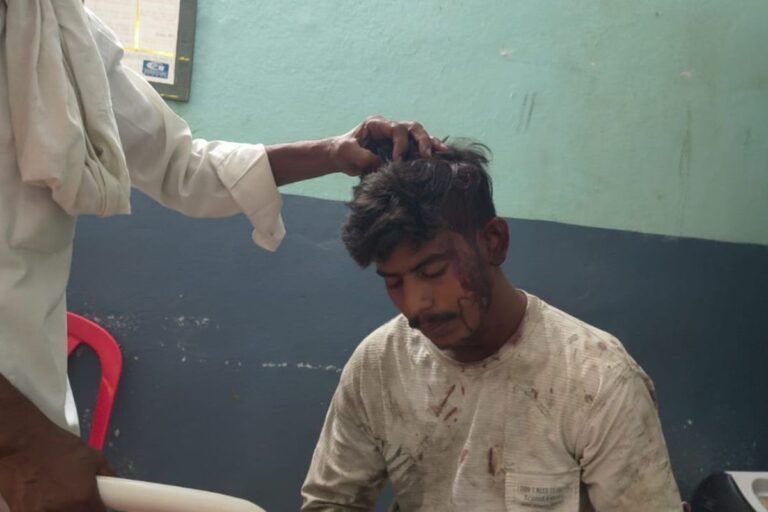 औरंगाबाद: बकाया मजदूरी मांगने गए युवक पर हमला, सिर फूटा; टेंट संचालक पर मारपीट का आरोप