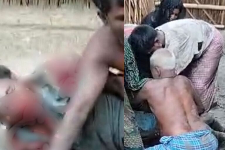वैशाली में आपसी विवाद में चाचा ने लोहे की रॉड से भतीजे का फोड़ा सिर, 3 गिरफ्तार