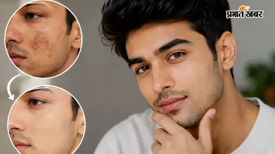 चेहरे के डार्क स्पॉट्स बिगाड़ रहे हैं आपका लुक, लड़के आज ही अपनाएं ये टिप्स