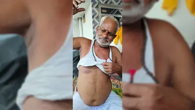 बेगूसराय में ज्वेलर्स पर हमला कर स्कूटी लूटी, पिस्तौल के बट से मारकर किया जख्मी, पुलिस ने लावारिस हालत में बरामद की गाड़ी