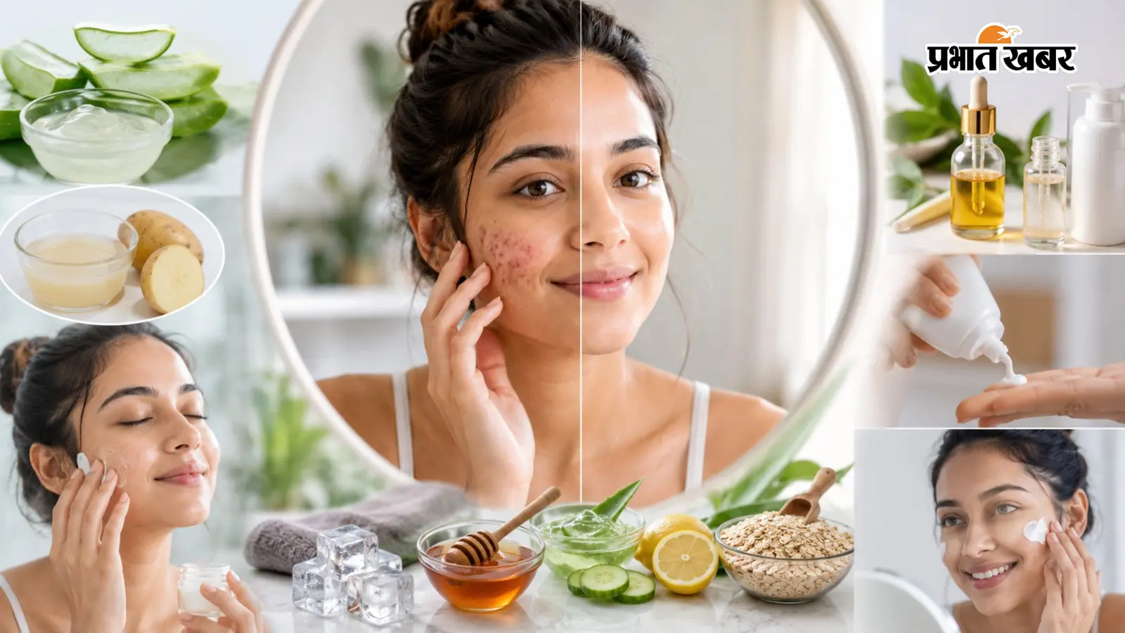 पिंपल्स के दागों से छुटकारा पाने के लिए क्या करें? Ai image पिंपल्स के दागों से छुटकारा पाने के लिए क्या करें? Ai image