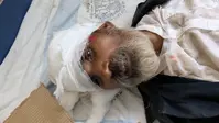 ठाकुरगंज में NH-327A पर हादसा: अज्ञात वाहन की चपेट में आने से अधेड़ की मौत