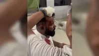 मानपुर में मशीन लिफ्टिंग के विवाद में पहले क्रेन संचालक से थाना में हुआ समझौता, कुछ घंटे बाद ही पीड़ित पर हमला कर लूट