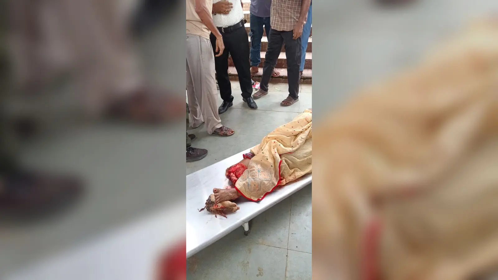 हंसडीहा स्टेशन पर घायल महिला | Prabhat Khabar Network हंसडीहा स्टेशन पर घायल महिला | Prabhat Khabar Network