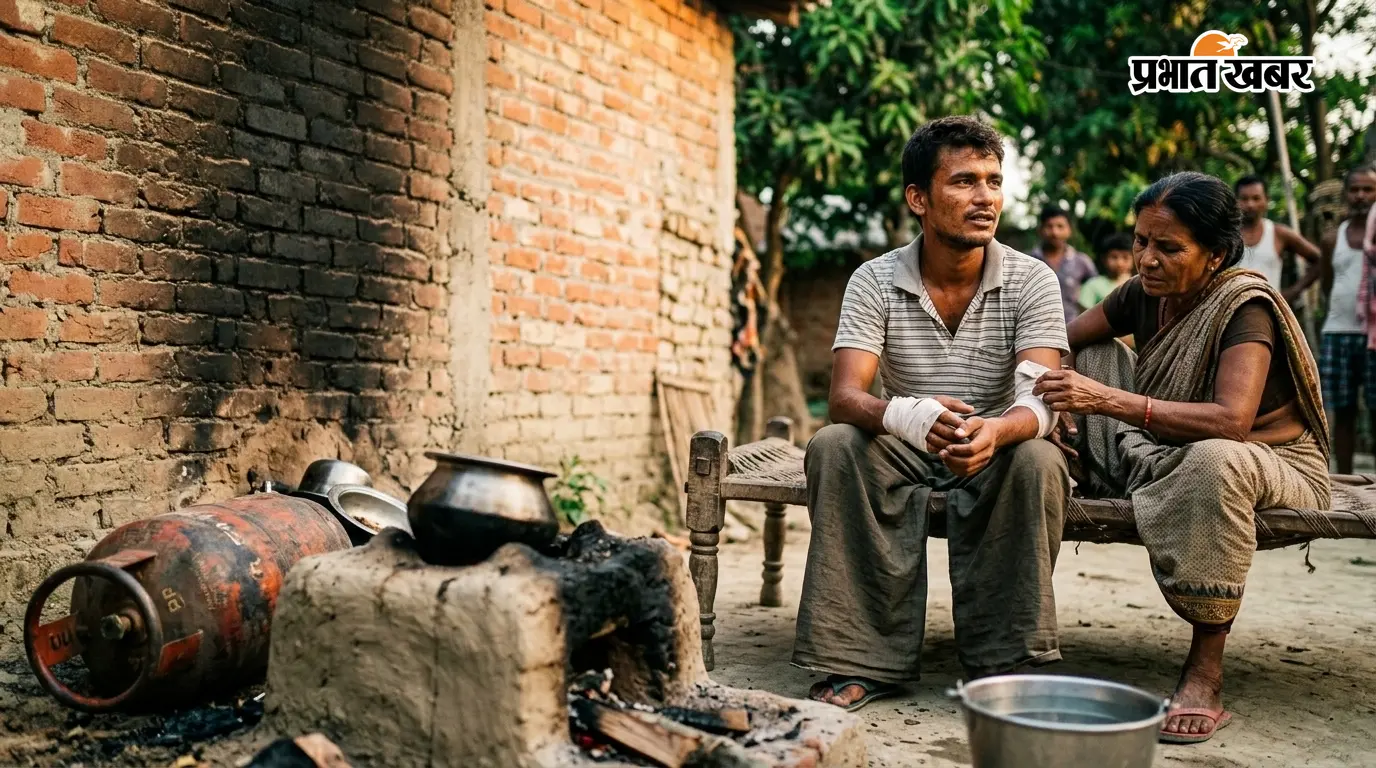 बारा: खाना बनाते समय गैस लीक, युवक झुलसा बारा: खाना बनाते समय गैस लीक, युवक झुलसा