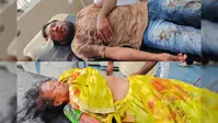पूजा कर लौट रही महिला की सड़क हादसे में मौत, भतीजा गंभीर रूप से घायल
