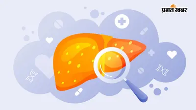 झारखंड में 28 जुलाई से चलाया जायेगा हेल्दी लिवर कैंपेन