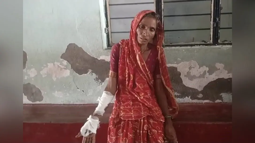 फोटो- 71- सदर अस्पताल में भर्ती घायल महिला | Prabhat Khabar Network फोटो- 71- सदर अस्पताल में भर्ती घायल महिला | Prabhat Khabar Network
