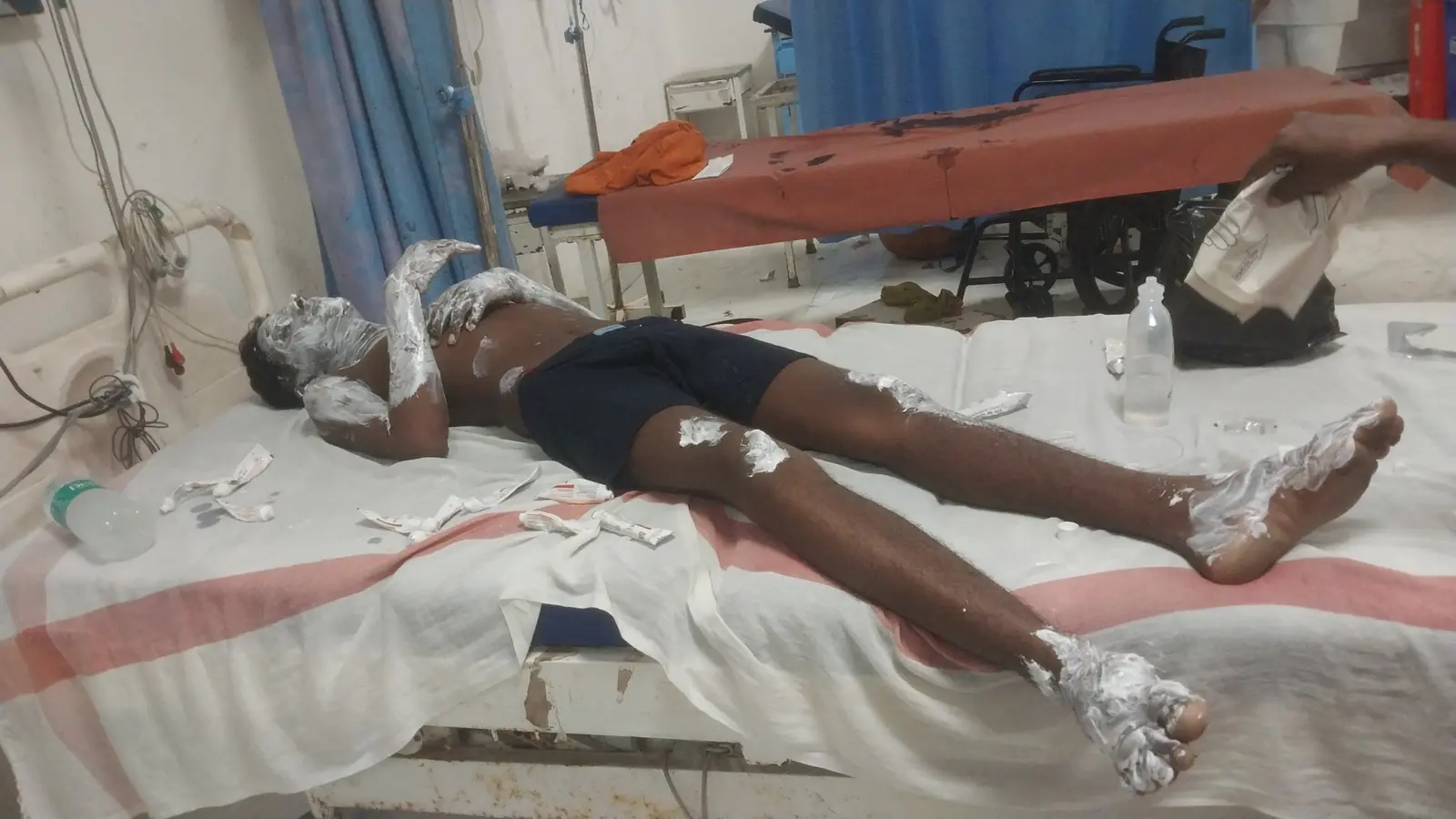 अस्पताल में इलाज रात बिट्टू कुमार | Prabhat Khabar Network अस्पताल में इलाज रात बिट्टू कुमार | Prabhat Khabar Network