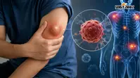 शरीर की हर गांठ सामान्य नहीं होती, एक्सपर्ट से जानिए इस 'Silent Cancer' के चेतावनी संकेत