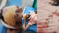 एनएच-331 पर दो बाइकों की आमने-सामने टक्कर, तीन युवक गंभीर रूप से घायल
