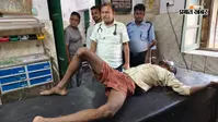 33 हजार वोल्ट की हाईटेंशन लाइन बनी जानलेवा, पेंटिंग कर रहे दो मजदूर गंभीर रूप से झुलसे, हायर सेंटर रेफर