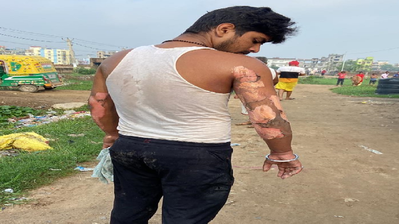 Patna Rajiv Nagar Live : राजीव नगर में हुई कार्रवाई को संजीव चौरसिया ने बताया दमनकारी, देखें फोटो-वीडियो